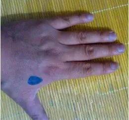 穴位|人体上居然还有“一键关机、一键清理”穴位,收藏以备不时之需!