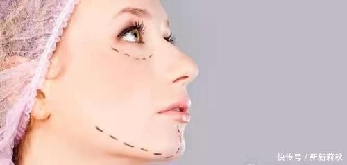 闺蜜|闺蜜小切口提升后悔做了小拉皮手术没效果别眨眼睛看我小拉皮效果~