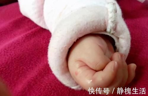 婴儿|宝宝拇指内扣，大脑会很笨？超过这个月龄没好转，就该及时就医