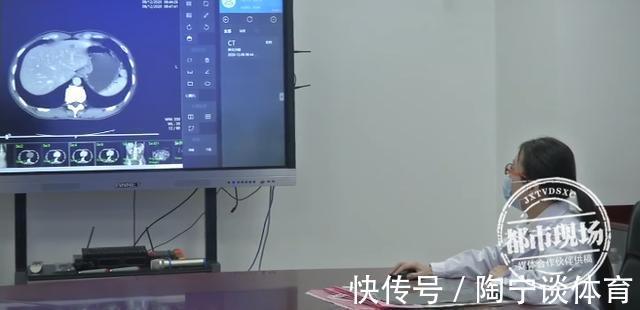 体检|女子年年体检“正常”,却被诊断为癌症晚期,医生一句话让众人警醒