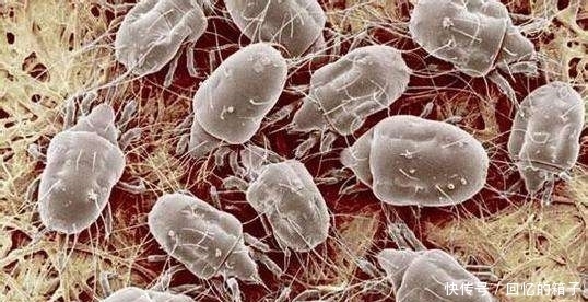 耳科医生:耳朵孔里经常痒,可能预示着4种病,最好别忽视!