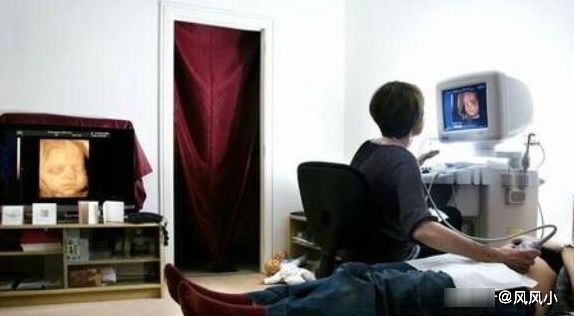 孕妇|孕妈做四维时,为什么宝爸不能进去?原来是这3个原因,难怪了!