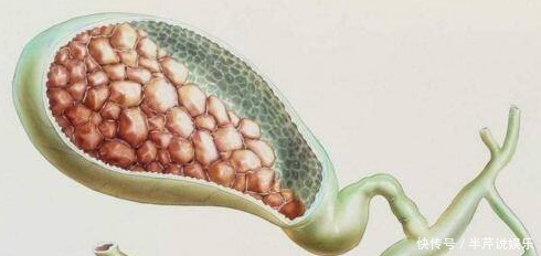 消失|日本专家不吃早餐,九成毛病都消失看完你或许会有一个权衡!