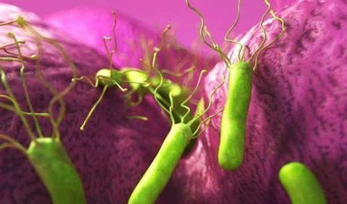 丁香茶|感染上幽门螺杆菌开水里泡点它,可以“斩草除根”,胃癌远离你