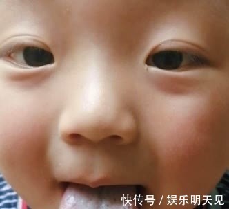 积食|6岁女童感冒半个月,原来是积食造成的,医生:这些食物千万别喂