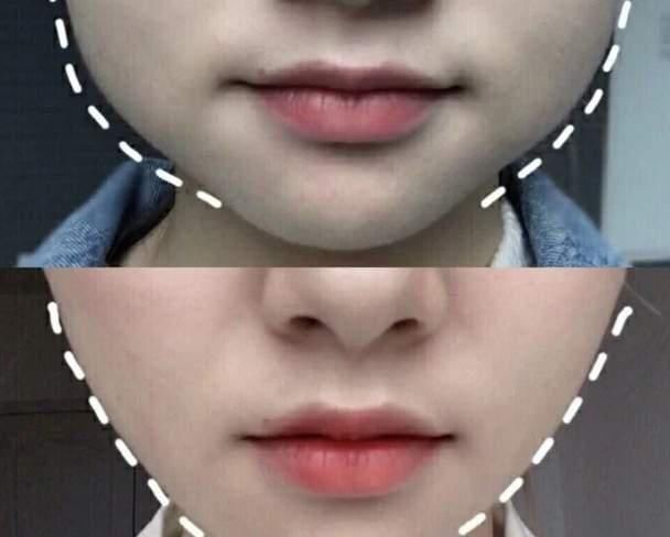 脸胖还有分类型？挑选适合的瘦脸操运动 轻松消除双下巴