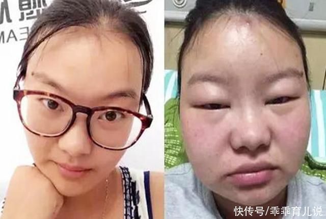 妊娠纹|一组女性生娃前后“对比图”火了,隐藏了妊娠纹,差距也显而易见