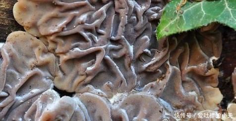 甲状腺|甲状腺结节别害怕,做到2吃2不吃,“结节”随时会偷偷的溜走