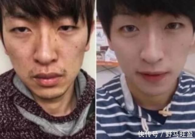 “长期化妆”和“长期素颜”有什么差别，哪个对皮肤好请尽早了解