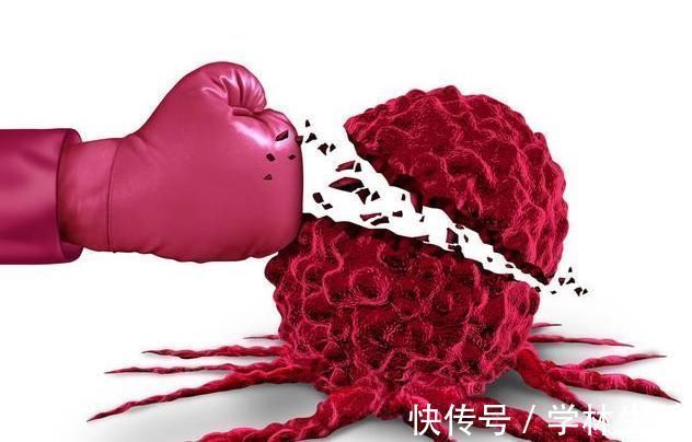癌细胞|晚期癌症能活5年么肿瘤专家解释，正确治疗5年很有可能