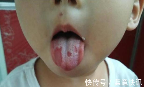 积食|宝宝积食不吃饭,妈妈用2个水果通通解决,还有助于长个子!