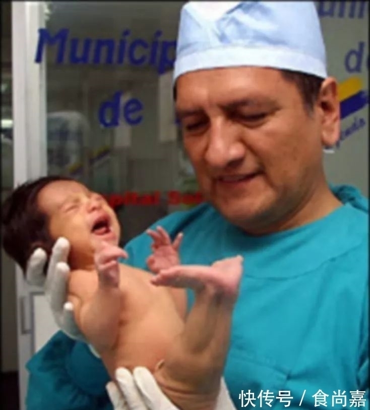 希洛|被称为“美人鱼女孩”:一生活在闪光灯下,从未停下摇摆“尾巴”