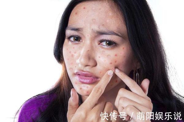 阴虚体质|黄芪药用价值很高,提醒:如果你是这5类人中之一,最好别吃黄芪