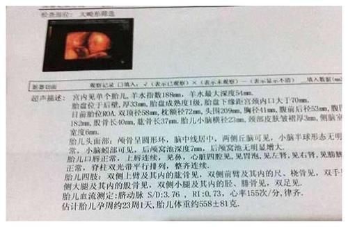 b超单|孕检时,B超单上的这3个数据,可能代表怀了个“小帅哥”