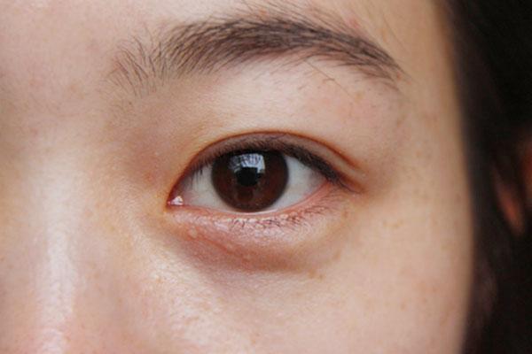 口腔溃疡|维生素B2不足,损害有多大几块钱一瓶维生素B2,天天吃会怎样