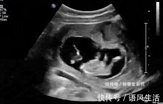 腹中小宝宝|为什么胎儿总在晚上踢妈妈主要原因有3个,你要学会分辨