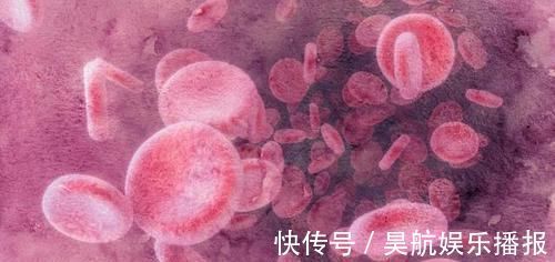 眼角膜|血脂超标怎么办？“3黄”请撤离饭桌，稳定血脂，血管可能更畅通