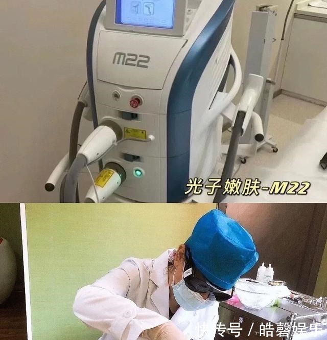 橡皮筋弹 半年内做了3次光子嫩肤,光子嫩肤真实反馈!