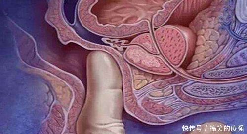 妇科常规检查|孕妇们想要顺产,躲不过这项检查,做过的都说很尴尬