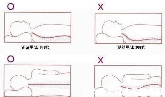 仰卧位|预防颈椎病,睡眠姿势很关键,听听医怎么说