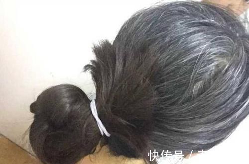 黑发|白头发拔1根长10根?3个“狠角色”,白发、脱发全拿下,显年轻