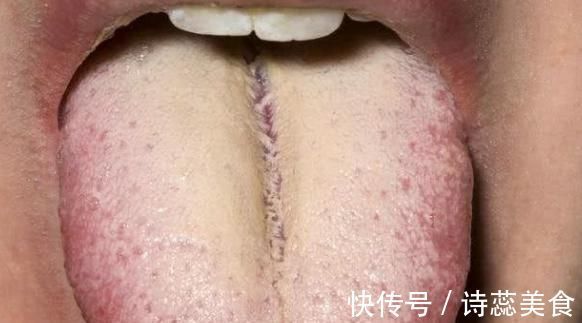 肝功能|肝不好的人，头部会有3处“发黄”，若没有，你就偷着乐吧！