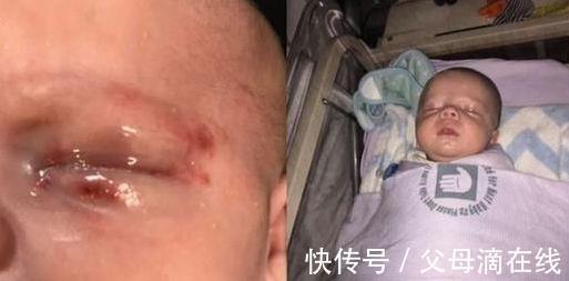 指甲|带孩子出门,第一防人贩子,第二防这种人