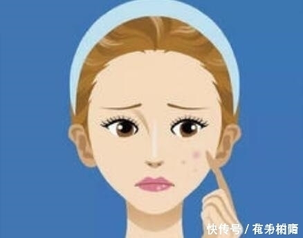 痘印害怕两样东西,适当用一些,美白皮肤还能去痘印