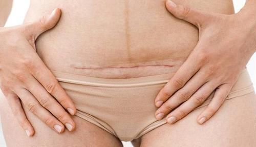 生产方式|生孩子真的好害怕！自然产、剖腹产，准妈妈将如何选择？