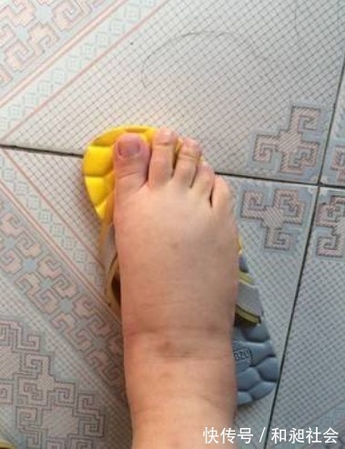 水肿|孕期中,5样东西要常换更要挑贵的买,孕妈别对自己太“抠门”