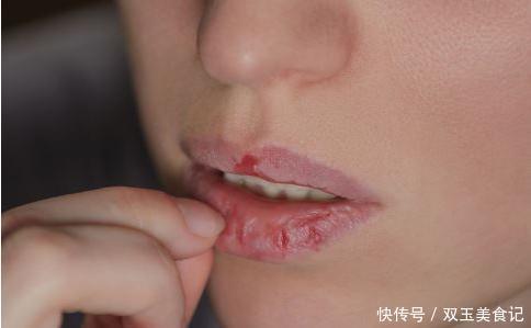 嘴唇|嘴唇总是反复干裂、起皮咋办?别撕别舔,4个非常润唇法教会你
