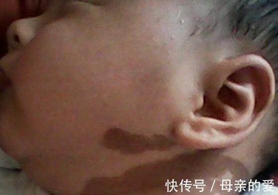 妈妈们|怀孕期间孕妈坏脾气对胎儿有影响,莫等宝宝畸形才知错