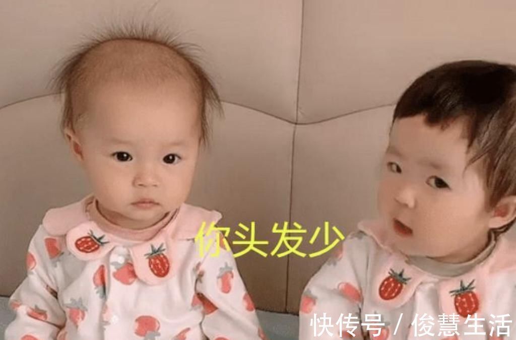 遗传物质|最好认的双胞胎走红,发量一个随妈一个随爸,网友:妈妈真偏心