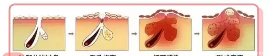 全网|你的护肤方式上黑名单了吗?辟谣10个火爆全网的烂脸护肤伪科学