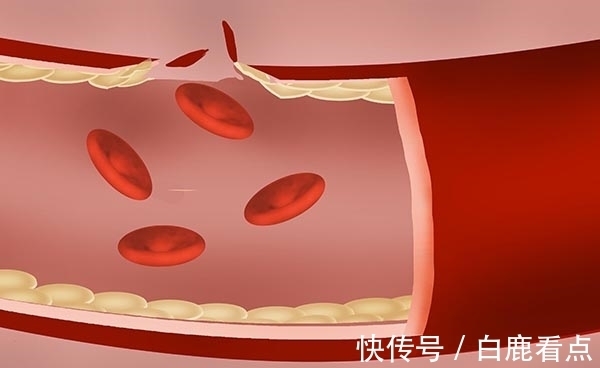 智力障碍|因为相同病症，兄弟俩接连丧子五次，有遗传病的夫妻生孩子要谨慎