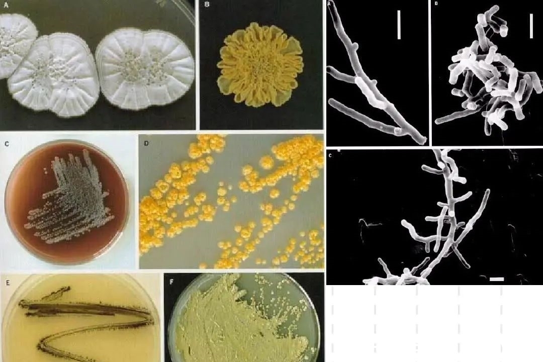 线菌|男子手摸一物后住院7次,这种古玩不要随便乱摸,不小心会丢命!