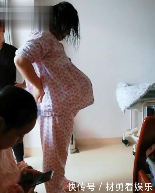 皮肤|孕妈晒“悬浮肚”走红,人人说是双胞胎,孕妈遭遇让人心疼又担心