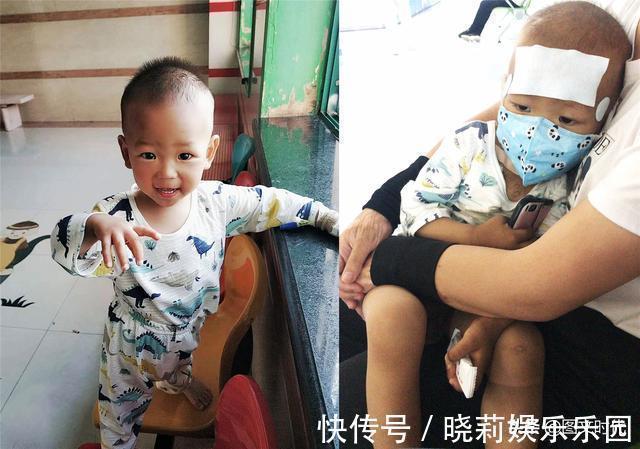 小承恩|1岁男童总尿频,送医查出恶性肿瘤,爸爸:他这么小,怎么会这样