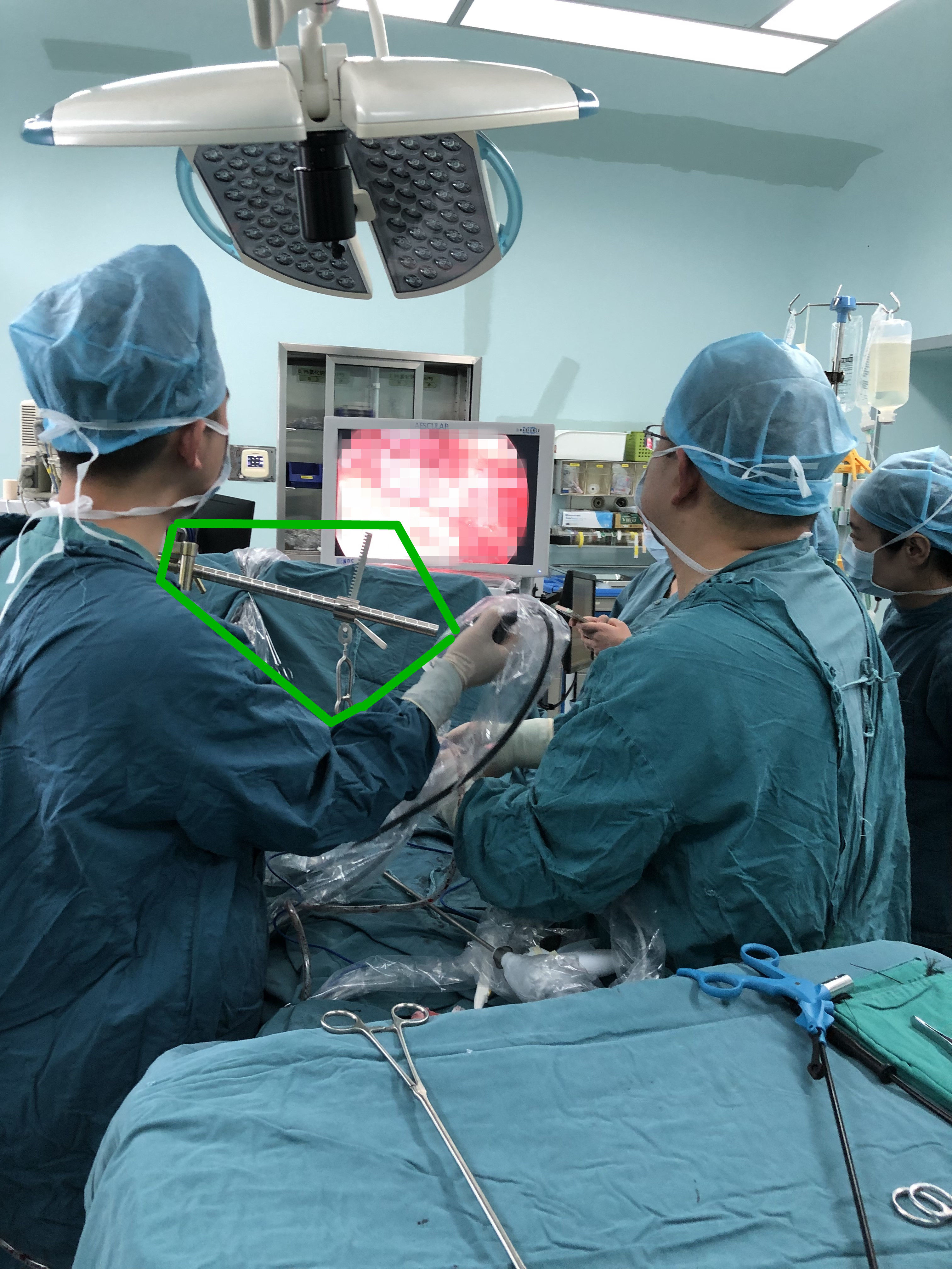 武汉市肺科医院|肺部肿瘤期待手术除病又怕挨刀,医生找到一个不疼的“入胸”通道