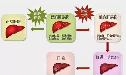 黄大姐|55岁河北大姐肝病晚期,医生惋惜:身体早有症状,只怪她没当回事