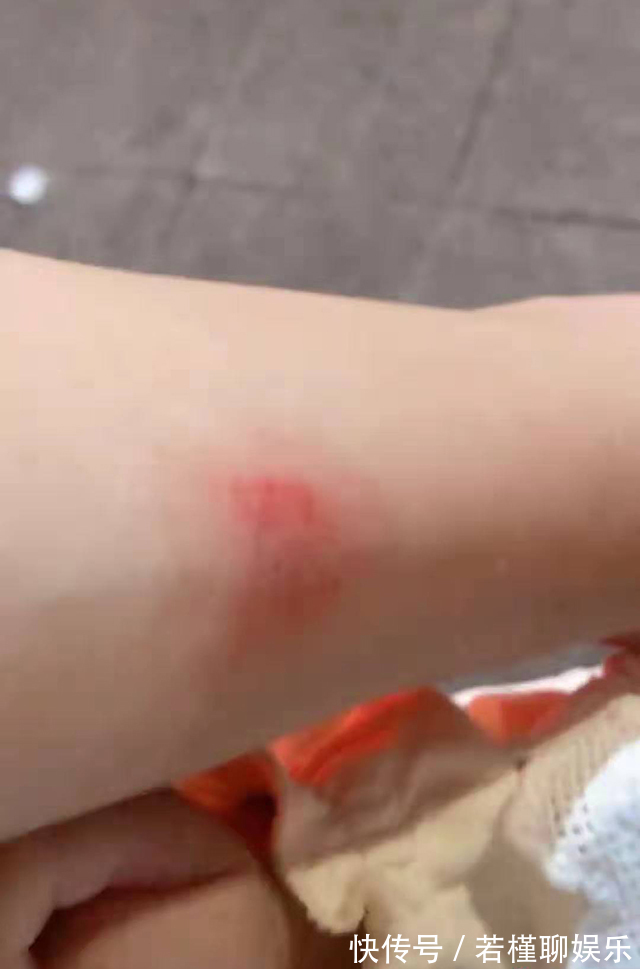 力气|宝宝“吃奶的力气”到底有多大宝妈用胳膊做实验,看完心疼妈妈