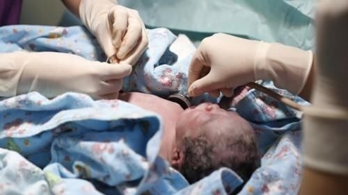 分娩|生出孩子的瞬间是啥体验？宝妈的描述太真实，生前生后两重天