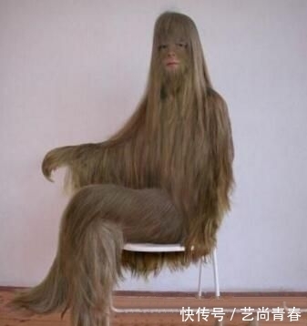毛发|世界上体毛最多的女孩完成了人猿逆袭,脱毛后变美女,不可思议
