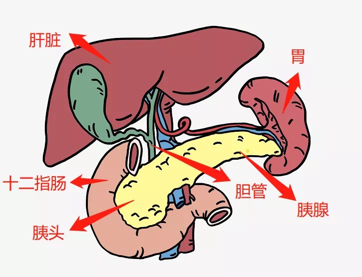 十二指肠|老是肚子痛，26岁小伙体检检出胰头长了“瘤”！医生用微创完成保留十二指肠胰头切除术解难题