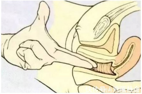 内检|内检时手指要伸进去多少一起来看看过来人的经历