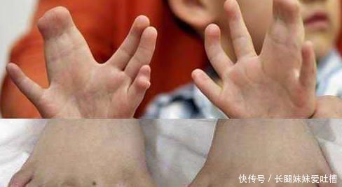 产检|“喜脉”到底是怎么摸出来的其实很容易,大家都可以自己试试看
