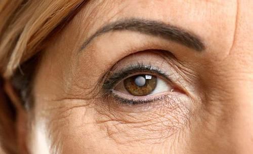 食物|女人若有5种表现,暗示体内雌激素不足,多吃3种食物,可补充