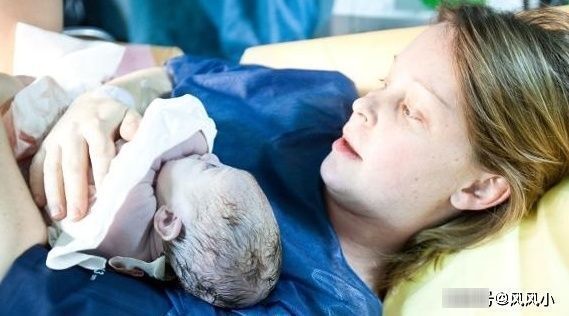 时间点|剖腹产时,若你赶上这个时间点,或许对产妇和宝宝都好!