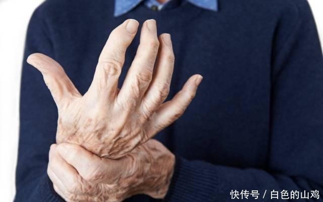 身体|身体出现4个表现,可能是尿酸高了,控尿酸,建议“3多2少”