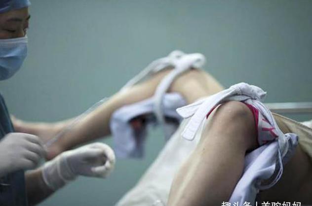 流产手术用全麻,为什么剖腹产只用半麻?